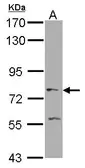 Anti-PKC zeta antibody used in Western Blot (WB). GTX111598