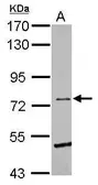 Anti-EphB6 antibody [C1C3] used in Western Blot (WB). GTX111601