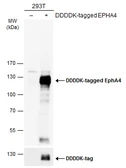 Anti-EphA4 antibody [N3C2-2], Internal used in Western Blot (WB). GTX111602