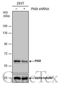 Anti-PKM antibody used in Western Blot (WB). GTX111604