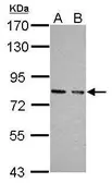 Anti-cGK1 antibody used in Western Blot (WB). GTX111610