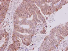 Anti-AKT2 antibody used in IHC (Paraffin sections) (IHC-P). GTX111612