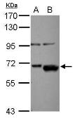 Anti-AKT2 antibody used in Western Blot (WB). GTX111612