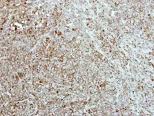Anti-CKMT2 antibody [N2C3] used in IHC (Paraffin sections) (IHC-P). GTX111620