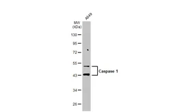 Anti-Caspase 1 antibody used in Western Blot (WB). GTX111630