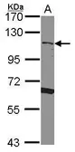 Anti-CD34 antibody [N2C3] used in Western Blot (WB). GTX111632