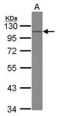 Anti-CD34 antibody [N1C1] used in Western Blot (WB). GTX111633
