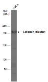 Anti-Collagen III antibody [C2C3-2], C-term used in Western Blot (WB). GTX111643