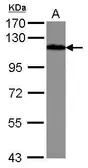 Anti-Drebrin antibody used in Western Blot (WB). GTX111649