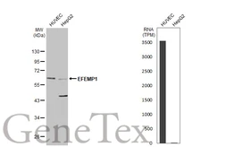 Anti-EFEMP1 antibody used in Western Blot (WB). GTX111656