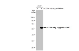 Anti-EFEMP1 antibody used in Western Blot (WB). GTX111657