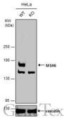 Anti-MSH6 antibody [C1C2], Internal used in Western Blot (WB). GTX111661