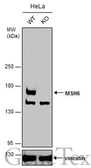 Anti-MSH6 antibody [C1C2], Internal used in Western Blot (WB). GTX111661