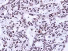 Anti-Lamin A + C antibody used in IHC (Paraffin sections) (IHC-P). GTX111677