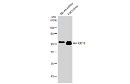 Anti-CD10 antibody [N2C1], Internal used in Western Blot (WB). GTX111680