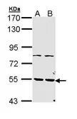 Anti-PDE1A antibody used in Western Blot (WB). GTX111687