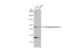 Anti-Transglutaminase 2 antibody [N1N3] used in Western Blot (WB). GTX111701