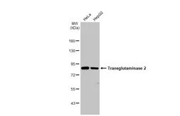 Anti-Transglutaminase 2 antibody [N3C3] used in Western Blot (WB). GTX111702