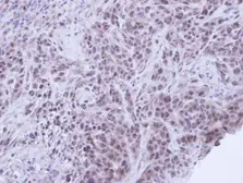 Anti-XRCC1 antibody [N1N3] used in IHC (Paraffin sections) (IHC-P). GTX111712