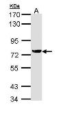 Anti-XRCC1 antibody [N1N3] used in Western Blot (WB). GTX111712