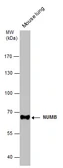 Anti-NUMB antibody [N1N3] used in Western Blot (WB). GTX111715