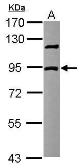 Anti-DCBLD2 antibody [N3C2], Internal used in Western Blot (WB). GTX111724