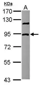 Anti-DCBLD2 antibody [N3C2], Internal used in Western Blot (WB). GTX111724