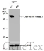 Anti-Adenylate kinase 2 antibody [N1C2] used in Western Blot (WB). GTX111726