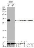 Anti-Adenylate kinase 2 antibody [N1C3-2] used in Western Blot (WB). GTX111737