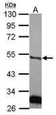 Anti-Urokinase antibody used in Western Blot (WB). GTX111747