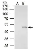Anti-ELP4 antibody used in Immunoprecipitation (IP). GTX111748