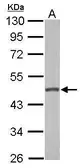 Anti-GALK2 antibody used in Western Blot (WB). GTX111750