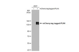 Anti-PLK4 antibody used in Western Blot (WB). GTX111754