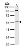 Anti-MPP1 antibody [N1C1] used in Western Blot (WB). GTX111779