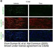 Anti-S100 beta antibody [SH-B4] used in IHC (Frozen sections) (IHC-Fr). GTX11179