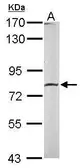 Anti-Calpain 2 antibody [N2C1-2], Internal used in Western Blot (WB). GTX111809