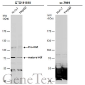 Anti-HGF antibody used in Western Blot (WB). GTX111810