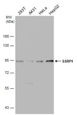 Anti-SSRP1 antibody [N1N3] used in Western Blot (WB). GTX111816