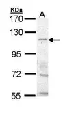 Anti-TRPM8 antibody [N2C1], Internal used in Western Blot (WB). GTX111818