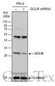 Anti-GCLM antibody [N1N3] used in Western Blot (WB). GTX111858