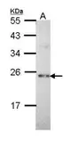 Anti-Calcium binding protein p22 antibody [N2C2], Internal used in Western Blot (WB). GTX111870