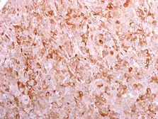 Anti-CD3 gamma antibody [C1C3] used in IHC (Paraffin sections) (IHC-P). GTX111878