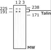 Anti-Talin antibody [8D4] used in Western Blot (WB). GTX11188