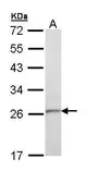 Anti-TSPAN6 antibody [C1C3] used in Western Blot (WB). GTX111881