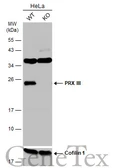Anti-PRX III antibody [C2C3], C-term used in Western Blot (WB). GTX111887