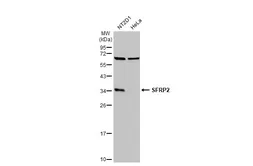 Anti-SFRP2 antibody [C2C3], C-term used in Western Blot (WB). GTX111892