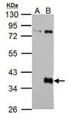 Anti-Wnt9b antibody [C2C3], C-term used in Western Blot (WB). GTX111893