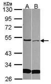 Anti-SFRP4 antibody [C2C3], C-term used in Western Blot (WB). GTX111897