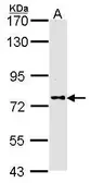 Anti-DPRP1 antibody [N1], N-term used in Western Blot (WB). GTX111905