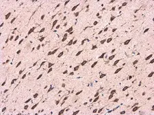 Anti-CDK5RAP1 antibody used in IHC (Paraffin sections) (IHC-P). GTX111910
